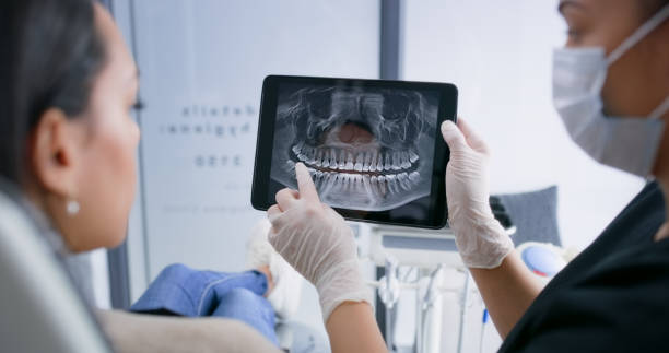 Licensed Tooth Extraction service in Dublin, OH - Smile Center Dentistry